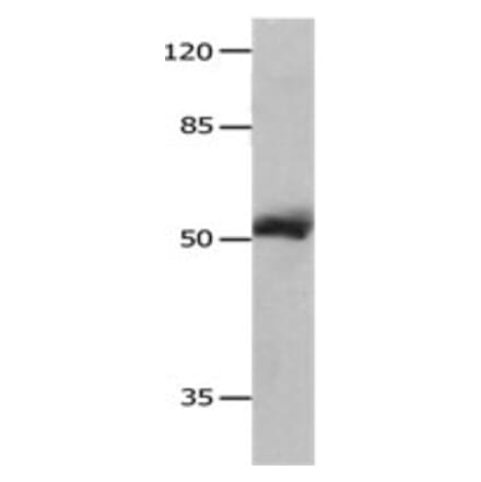 MMP8 Antibody from Signalway Antibody (31238) - Antibodies.com
