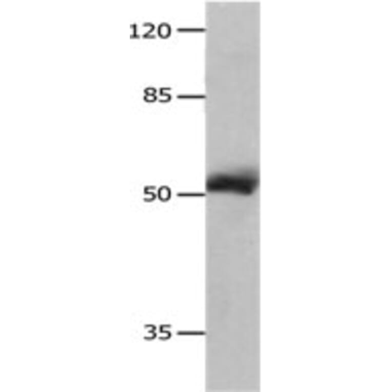 MMP8 Antibody from Signalway Antibody (31238) - Antibodies.com