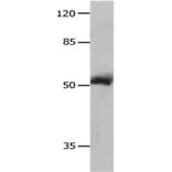 MMP8 Antibody from Signalway Antibody (31238) - Antibodies.com