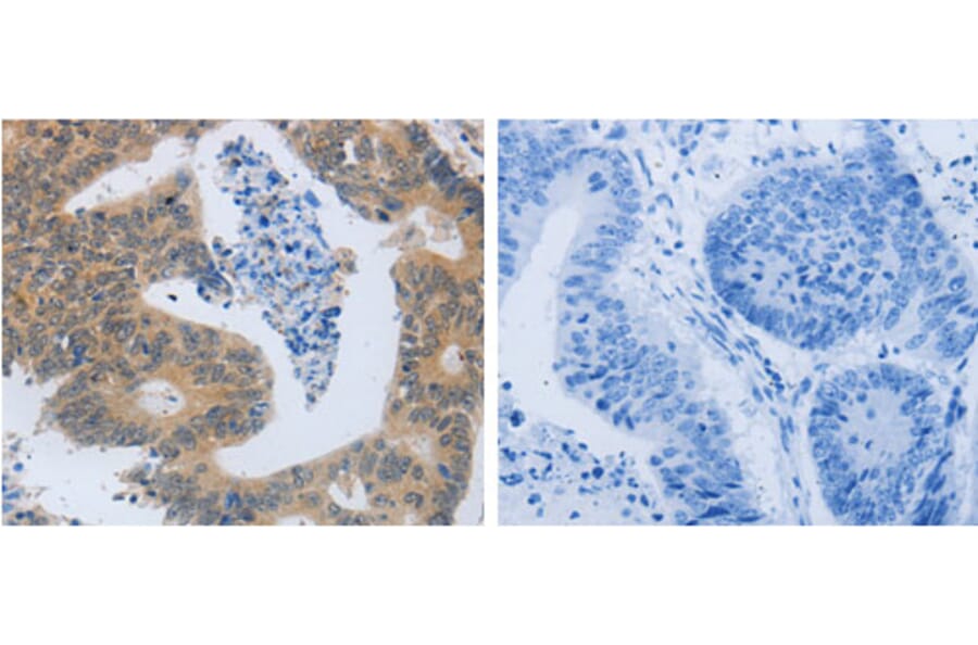 MMP8 Antibody from Signalway Antibody (31238) - Antibodies.com