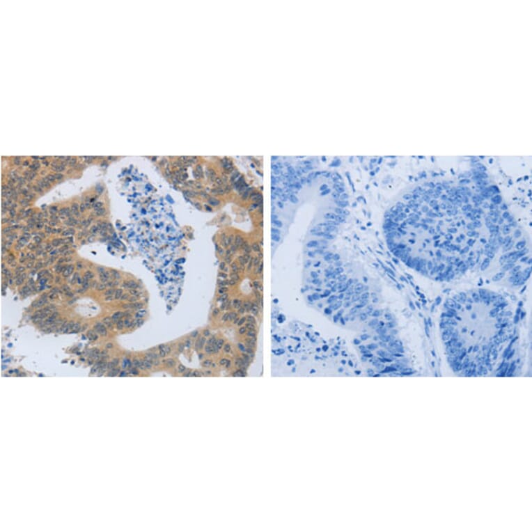 MMP8 Antibody from Signalway Antibody (31238) - Antibodies.com