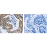 MMP8 Antibody from Signalway Antibody (31238) - Antibodies.com