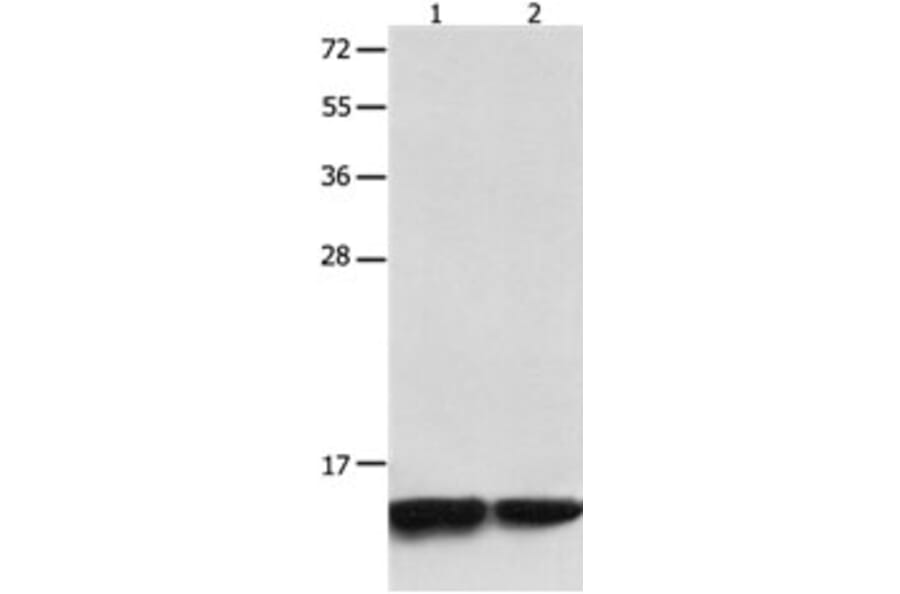 MYL9 Antibody from Signalway Antibody (31244) - Antibodies.com