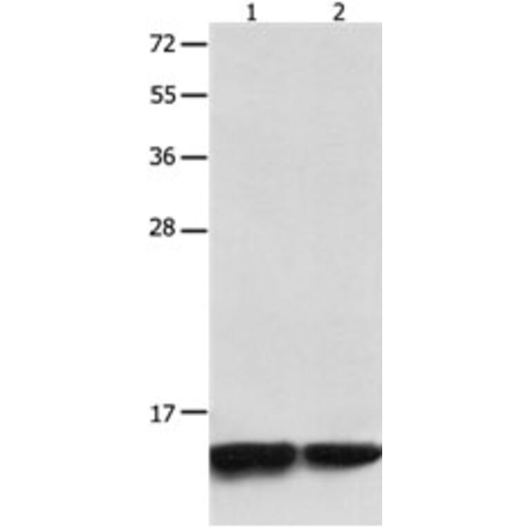 MYL9 Antibody from Signalway Antibody (31244) - Antibodies.com