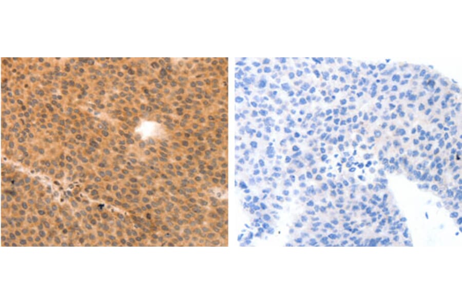 MYL9 Antibody from Signalway Antibody (31244) - Antibodies.com