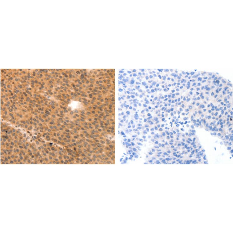 MYL9 Antibody from Signalway Antibody (31244) - Antibodies.com