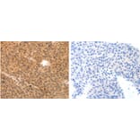 MYL9 Antibody from Signalway Antibody (31244) - Antibodies.com