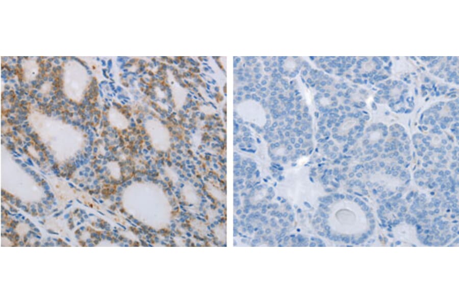 NCK2 Antibody from Signalway Antibody (31248) - Antibodies.com