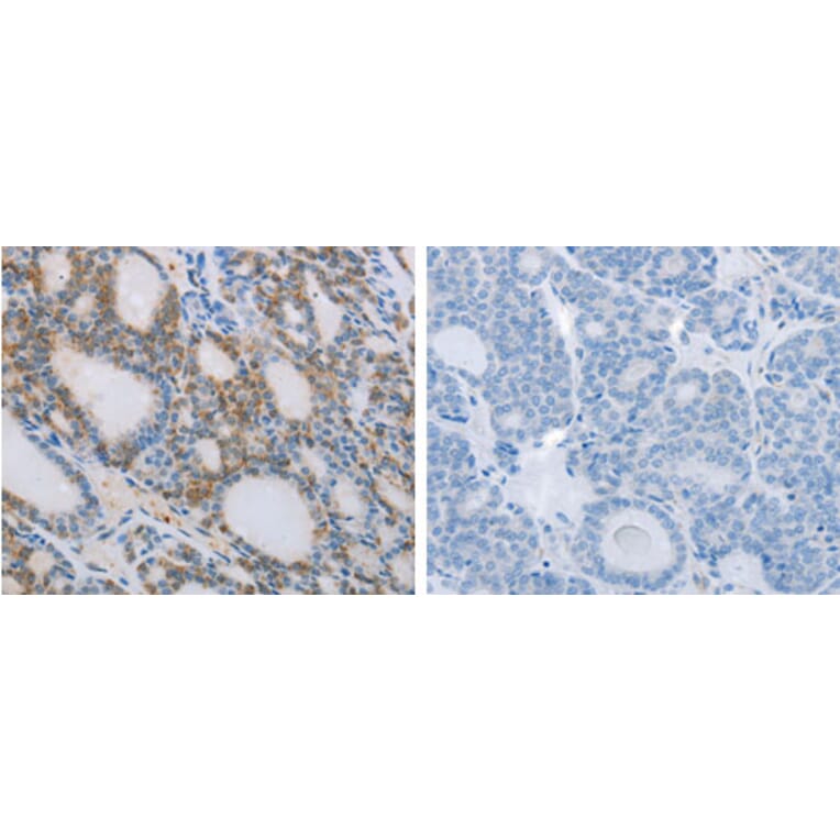NCK2 Antibody from Signalway Antibody (31248) - Antibodies.com