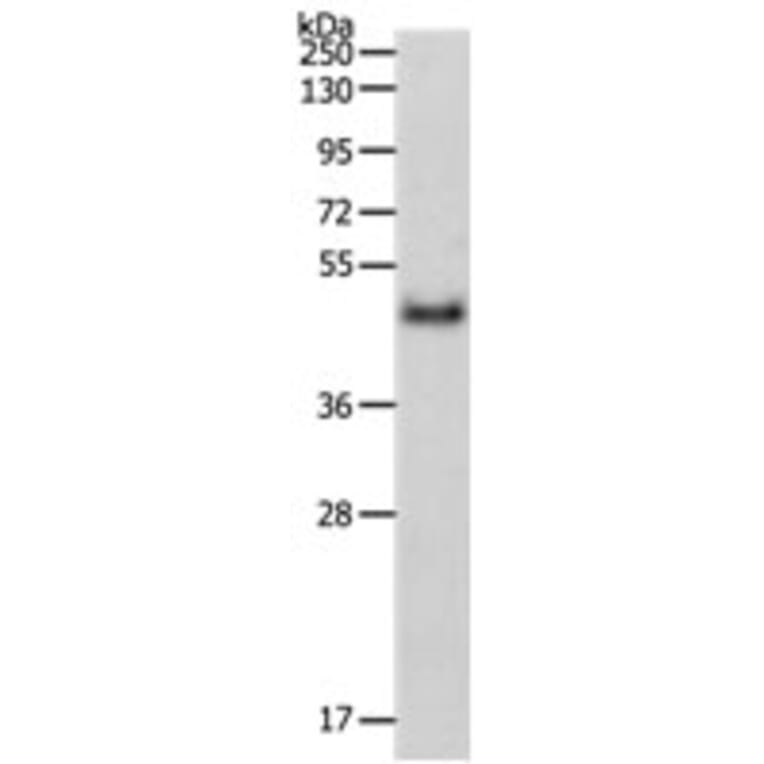 PDK4 Antibody from Signalway Antibody (31258) - Antibodies.com