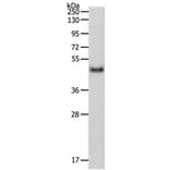 PDK4 Antibody from Signalway Antibody (31258) - Antibodies.com