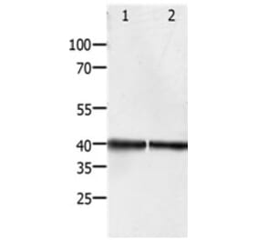 PDX1 Antibody from Signalway Antibody (31259) - Antibodies.com