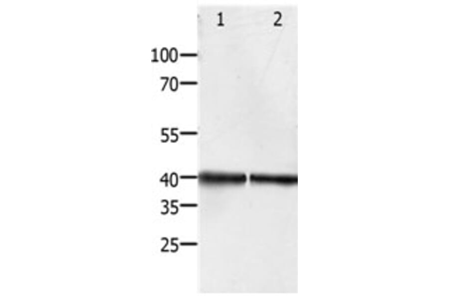 PDX1 Antibody from Signalway Antibody (31259) - Antibodies.com