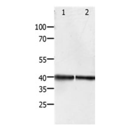 PDX1 Antibody from Signalway Antibody (31259) - Antibodies.com