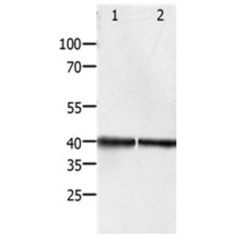 PDX1 Antibody from Signalway Antibody (31259) - Antibodies.com
