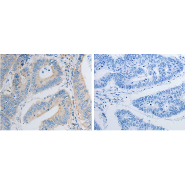 PDX1 Antibody from Signalway Antibody (31259) - Antibodies.com
