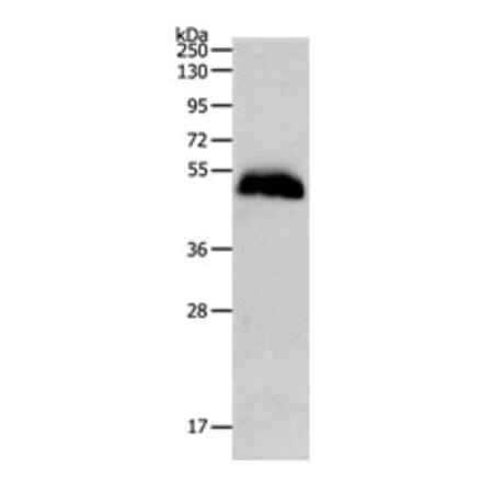 PGA3 Antibody from Signalway Antibody (31260) - Antibodies.com