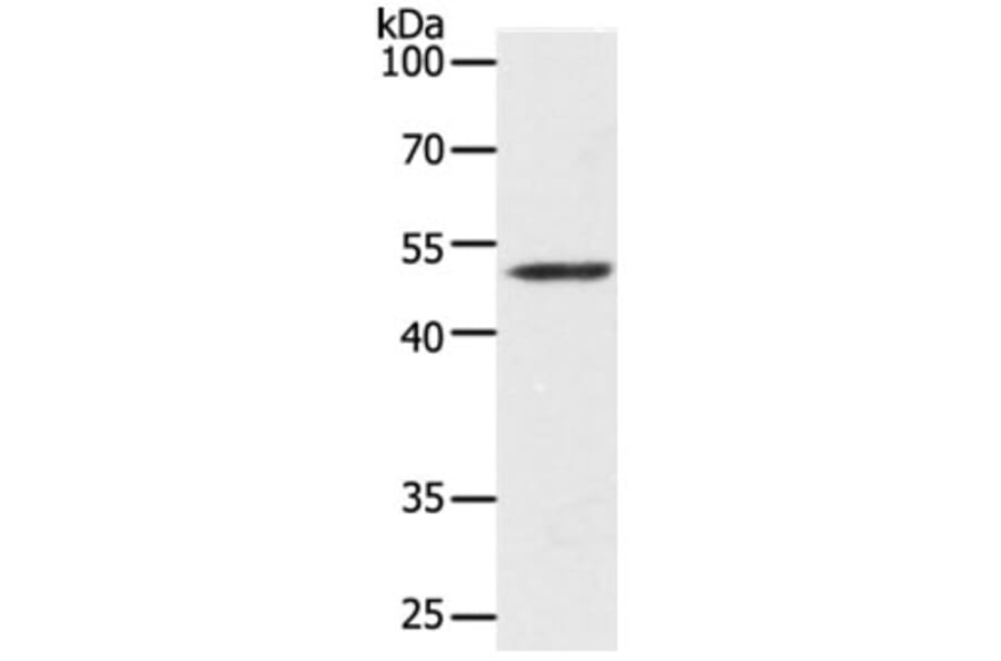 Map2 Antibody from Signalway Antibody (31273) - Antibodies.com