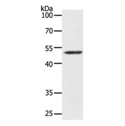 Map2 Antibody from Signalway Antibody (31273) - Antibodies.com