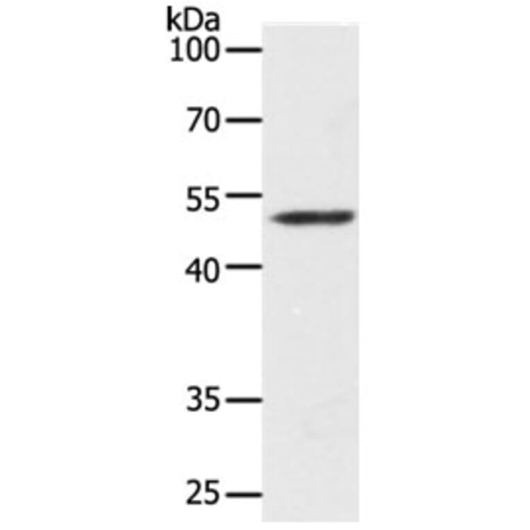 Map2 Antibody from Signalway Antibody (31273) - Antibodies.com