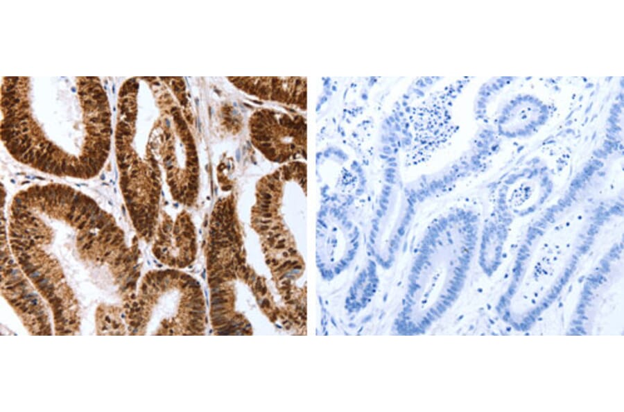 Map2 Antibody from Signalway Antibody (31273) - Antibodies.com