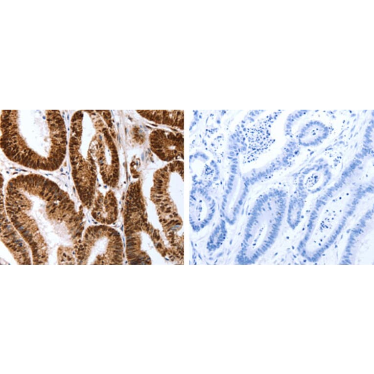 Map2 Antibody from Signalway Antibody (31273) - Antibodies.com