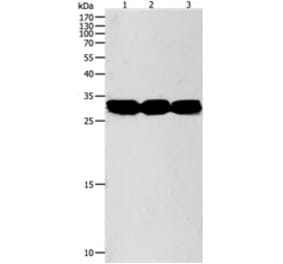 NIT2 Antibody from Signalway Antibody (31280) - Antibodies.com