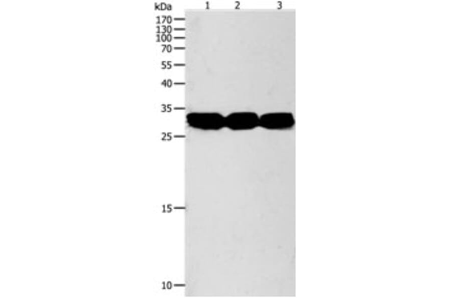 NIT2 Antibody from Signalway Antibody (31280) - Antibodies.com