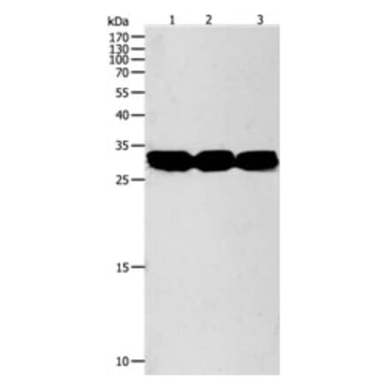 NIT2 Antibody from Signalway Antibody (31280) - Antibodies.com