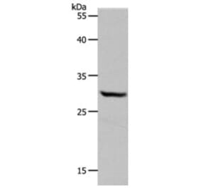 NQO1 Antibody from Signalway Antibody (31283) - Antibodies.com