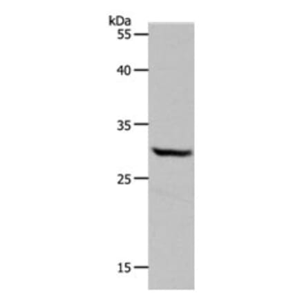 NQO1 Antibody from Signalway Antibody (31283) - Antibodies.com