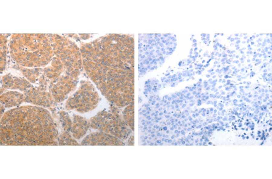 NQO1 Antibody from Signalway Antibody (31283) - Antibodies.com