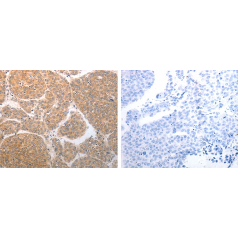 NQO1 Antibody from Signalway Antibody (31283) - Antibodies.com