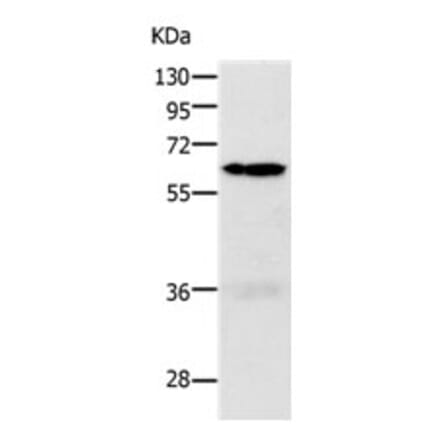 PAK1 Antibody from Signalway Antibody (31287) - Antibodies.com