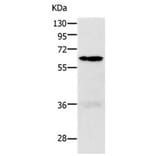 PAK1 Antibody from Signalway Antibody (31287) - Antibodies.com