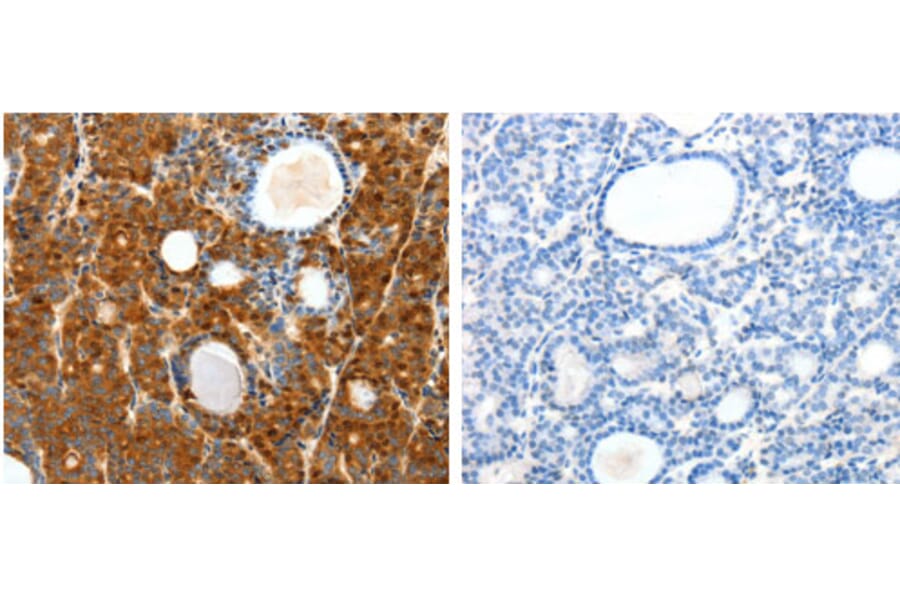 SCTR Antibody from Signalway Antibody (31290) - Antibodies.com