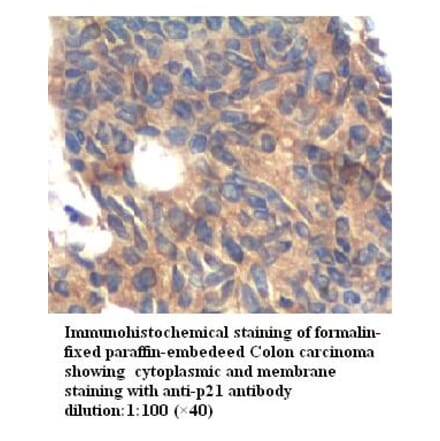 p21 Antibody from Signalway Antibody (39261) - Antibodies.com