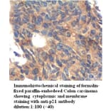 p21 Antibody from Signalway Antibody (39261) - Antibodies.com