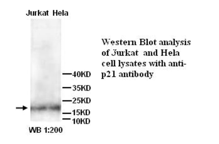 p21 Antibody from Signalway Antibody (39261) - Antibodies.com
