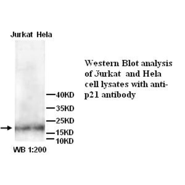 p21 Antibody from Signalway Antibody (39261) - Antibodies.com