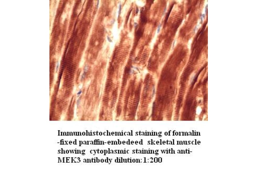 MEK3 Antibody from Signalway Antibody (39271) - Antibodies.com
