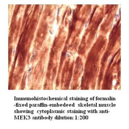 MEK3 Antibody from Signalway Antibody (39271) - Antibodies.com