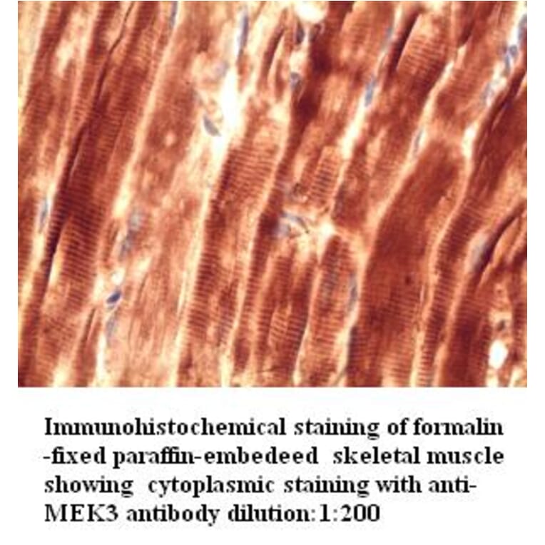 MEK3 Antibody from Signalway Antibody (39271) - Antibodies.com