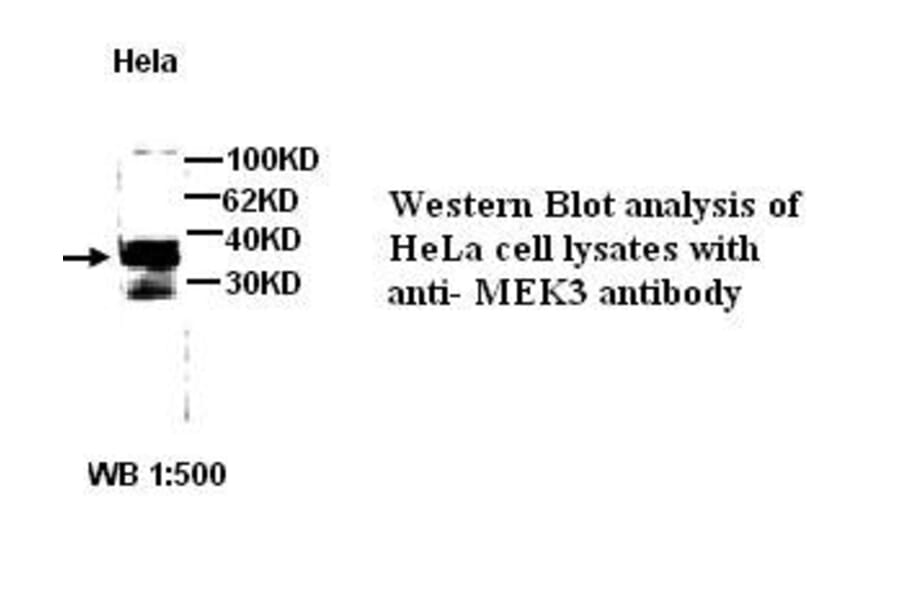 MEK3 Antibody from Signalway Antibody (39271) - Antibodies.com