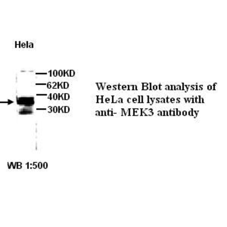 MEK3 Antibody from Signalway Antibody (39271) - Antibodies.com