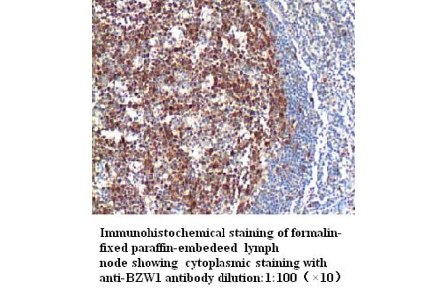 BZW1 Antibody from Signalway Antibody (39275) - Antibodies.com