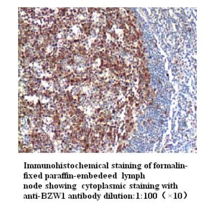 BZW1 Antibody from Signalway Antibody (39275) - Antibodies.com
