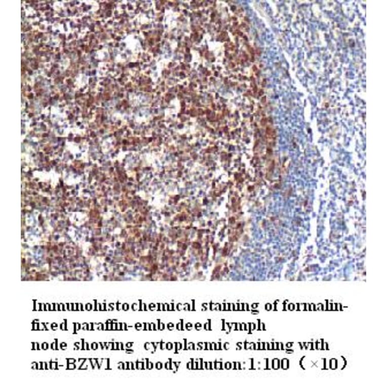 BZW1 Antibody from Signalway Antibody (39275) - Antibodies.com