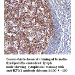 BZW1 Antibody from Signalway Antibody (39275) - Antibodies.com
