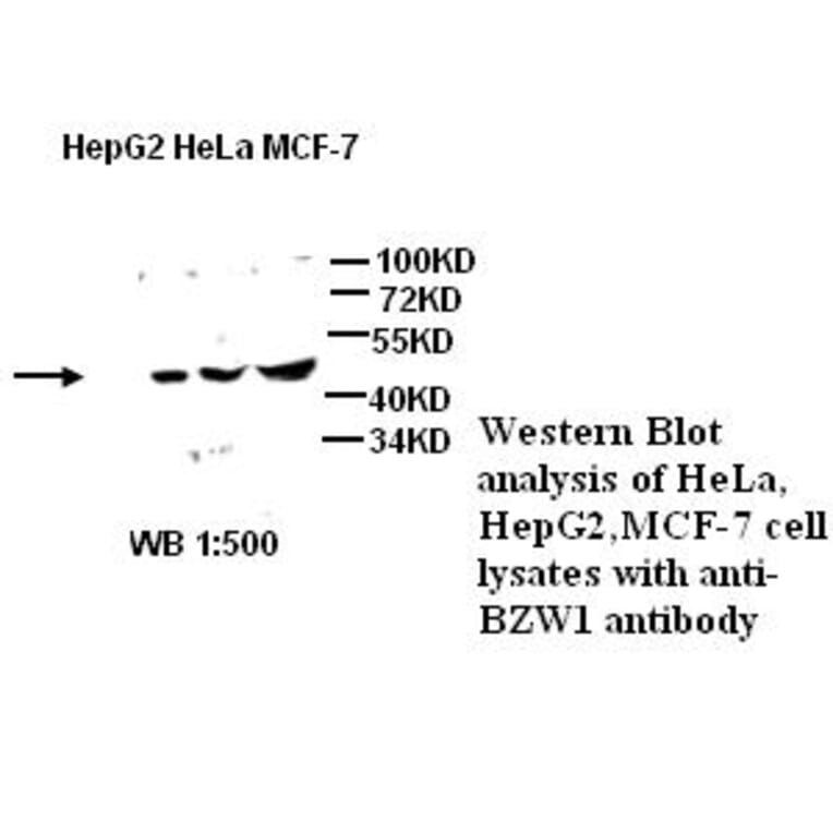BZW1 Antibody from Signalway Antibody (39275) - Antibodies.com
